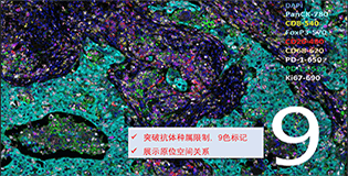 NGP（下一代病理技术）